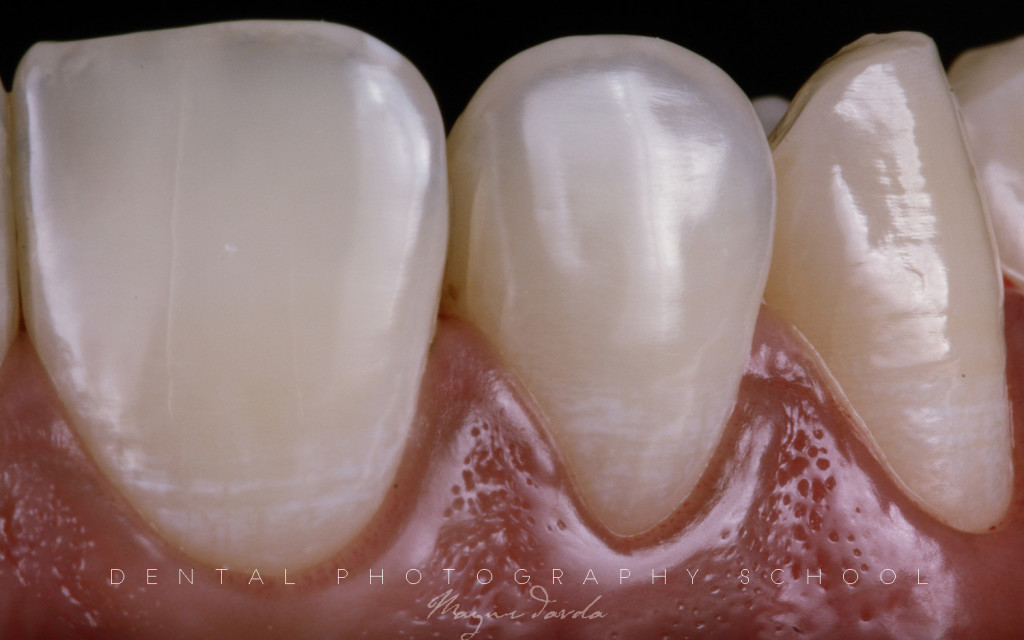 Dental Photography article Dr Mayur Davda