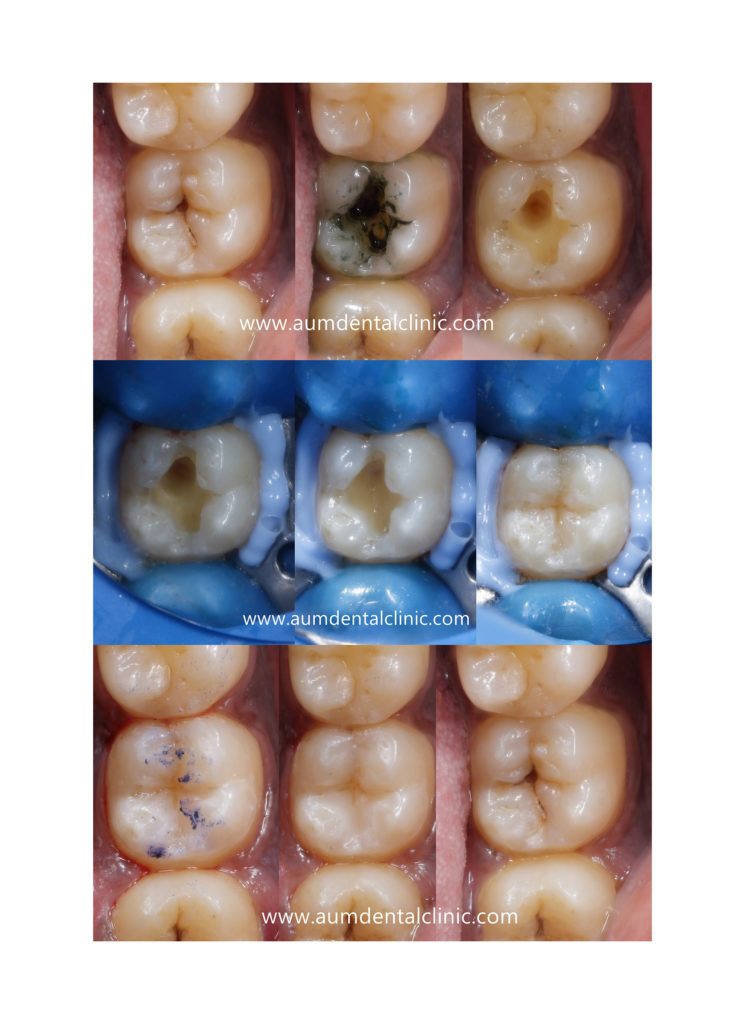 Dental photography