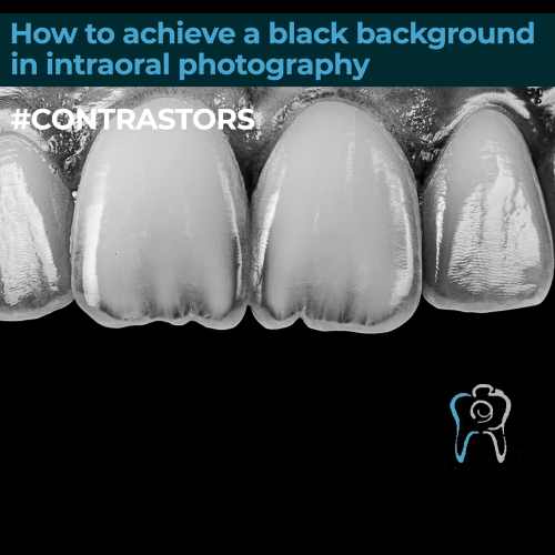 How to get a black background in intraoral photography flier