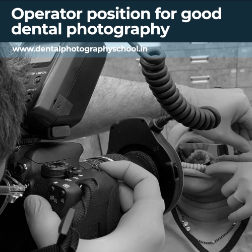 Operator position for good dental photography podcast