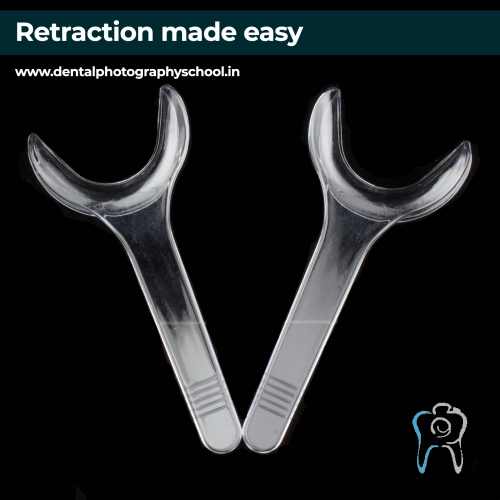 Retraction in dental photography a dental podcast by Dr Mayur Davda