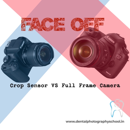 Crop sensor budget friendly or Full Frame expensive camera which is better for dental photography PODCAST