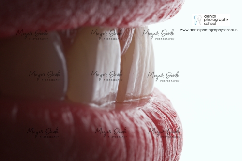 buy dental pictures images at 35 % discount