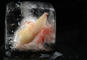 Tooth in ICE   